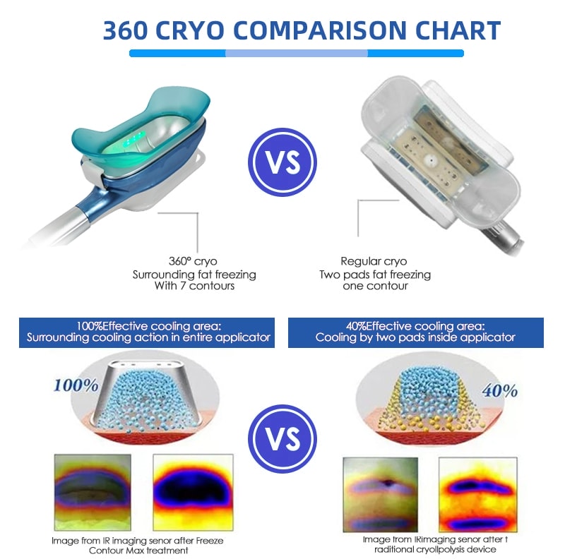 垂直 360 Cryo 脂肪凍結痩身マシン